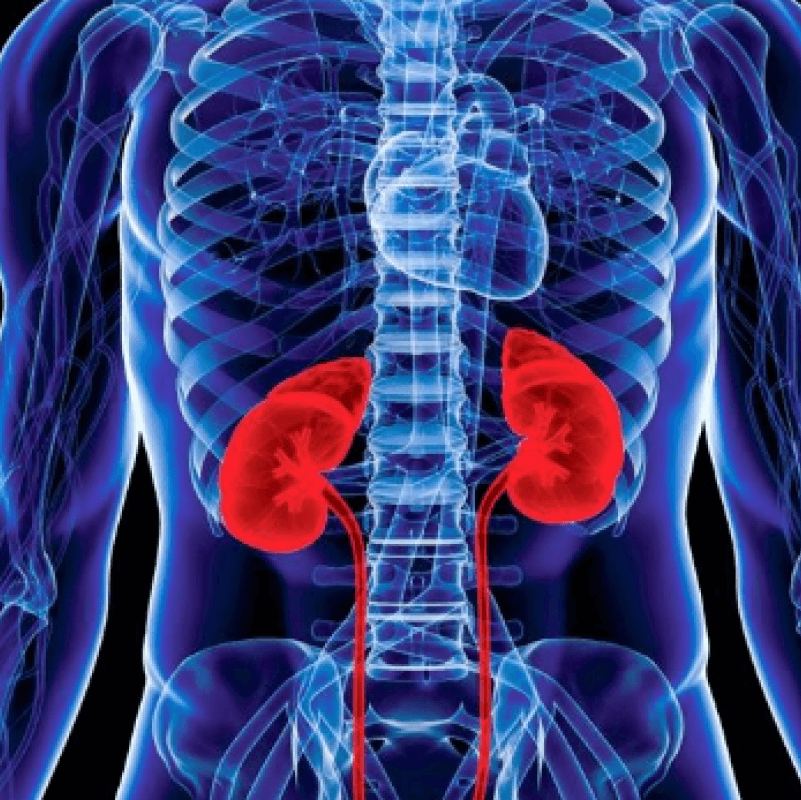 Người mắc bệnh thận mãn tính